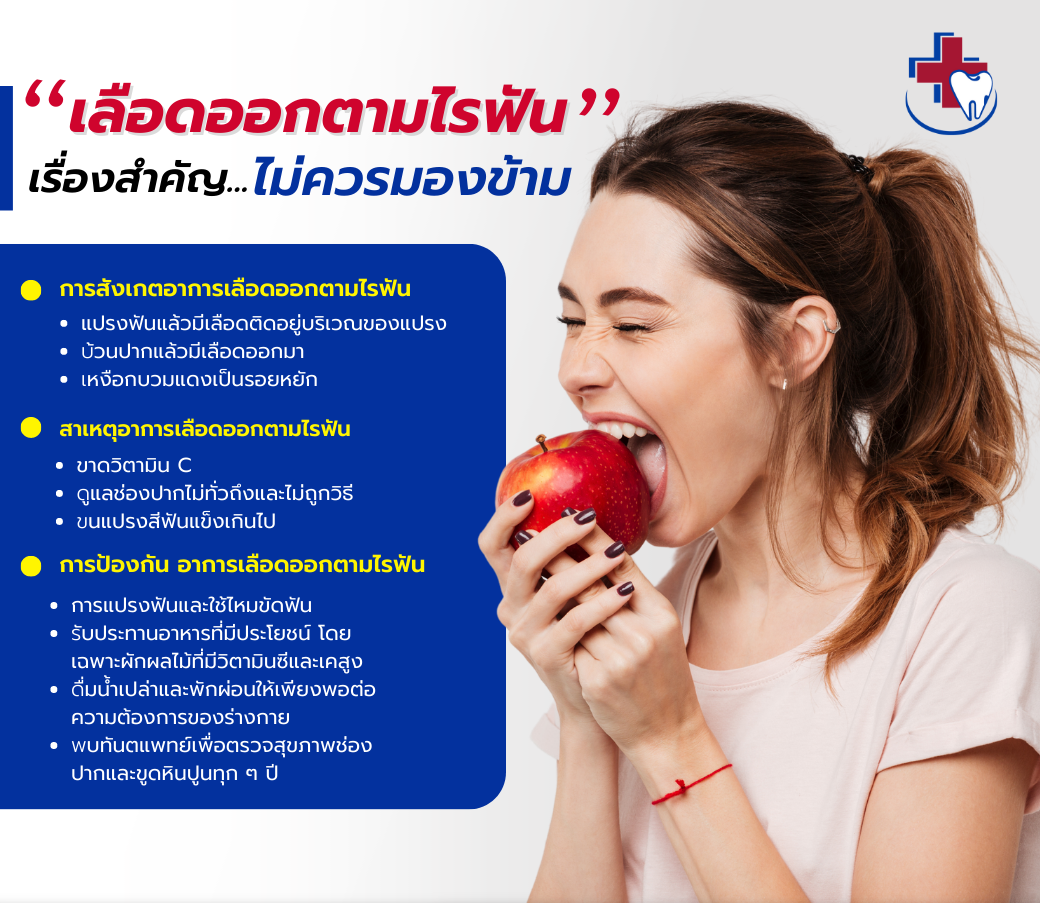 1.02032023 ‘เลือดออกตามไรฟัน' เรื่องสำคัญที่ไม่ควรมองข้าม.png